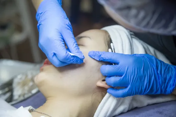 LASER THẨM MỸ