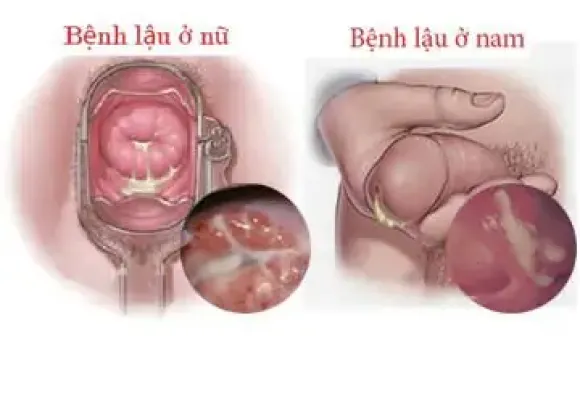 THẨM MỸ DA CHUYÊN SÂU