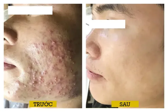 THẨM MỸ DA CHUYÊN SÂU